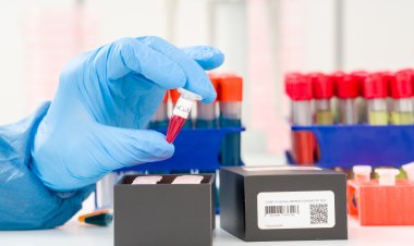 اكتشاف سلالة جديدة من كورونا بفرنسا لا يمكن كشفها بسهولة