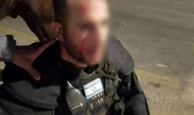 إصابة ضابطين كبيرين من شرطة الاحتلال خلال المواجهات في القدس