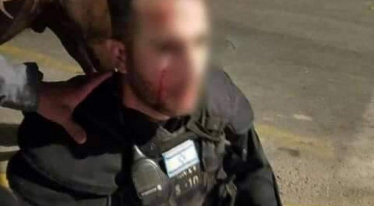إصابة ضابطين كبيرين من شرطة الاحتلال خلال المواجهات في القدس