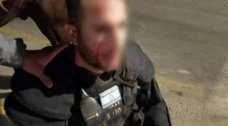 إصابة ضابطين كبيرين من شرطة الاحتلال خلال المواجهات في القدس