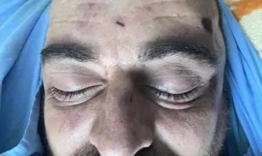 أمن السلطة يقمع مسيرة منددة بمقتل المعارض نزار بنات