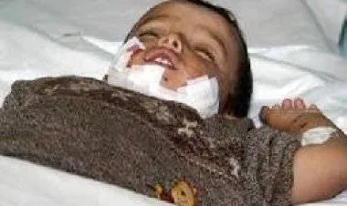 كلب ينهش 6 أطفال في العاصمة الأردنية عمّان.