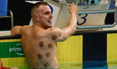 استخدام الرياضيين للحجامة يلفت الأنظار في أولمبياد طوكيو