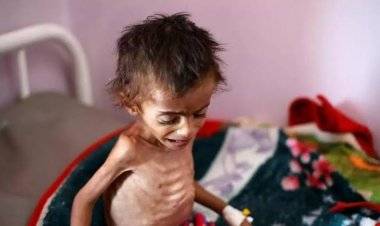 الأمم المتحدة تحذر من مجاعة تهدد الملايين في 23 منطقة مضطربة بالعالم