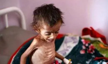 الأمم المتحدة تحذر من مجاعة تهدد الملايين في 23 منطقة مضطربة بالعالم