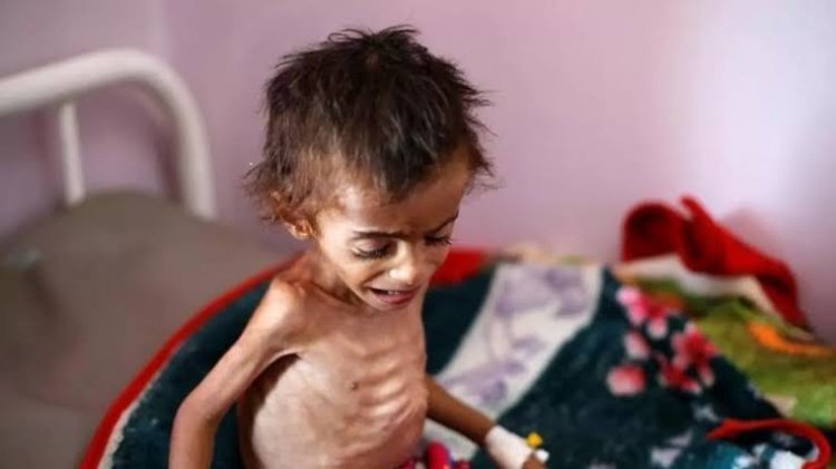 الأمم المتحدة تحذر من مجاعة تهدد الملايين في 23 منطقة مضطربة بالعالم