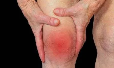 مشروب يمكنه عكس التهاب المفاصل وتسكين الآلام بشكل سريع!