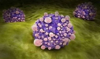 الكشف عن أعراض غير متوقعة لمرض السرطان