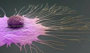 السرطان ينتشر في البلدان العربية بوتيرة تنذر بالخطر