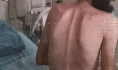 إعلام الأسرى ينشر حجم المعاناة التي يتعرض لها الأسير المضرب عن الطعام مقداد القواسمي