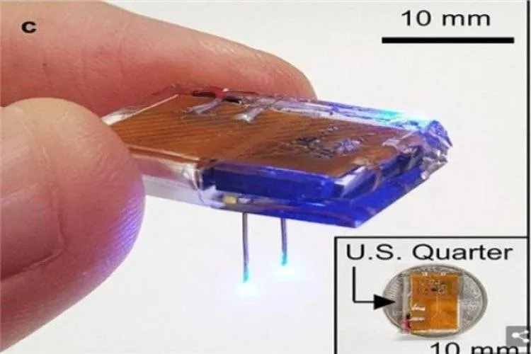 جهاز بحجم علبة الثقاب يوضع في الجمجمة لمعالجة مرض الاكتئاب الحاد.