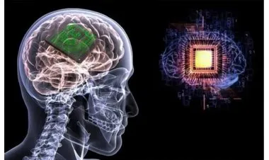 شريحة مزروعة بالدماغ تترجم الأفكار وتحولها إلى نصوص