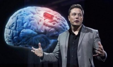 نكسة لجهود زراعة شرائح الكترونية في أدمغة البشر