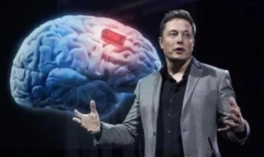 نكسة لجهود زراعة شرائح الكترونية في أدمغة البشر