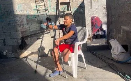 مكتب أممي: في غزة أكبر عدد للأطفال مبتوري الأطراف بالتاريخ الحديث