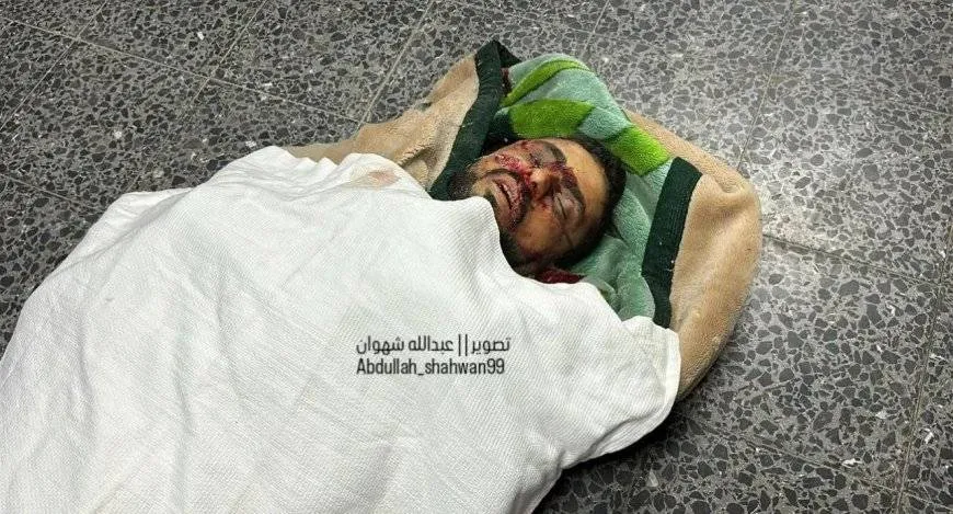 استشهاد الناطق باسم حركة حماس عبداللطيف القانوع جراء قصف الاحتلال خيمته في جباليا البلد شمال غزة