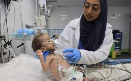 الصحة بغزة: 60 ألف طفل تهددهم مضاعفات سوء التغذية