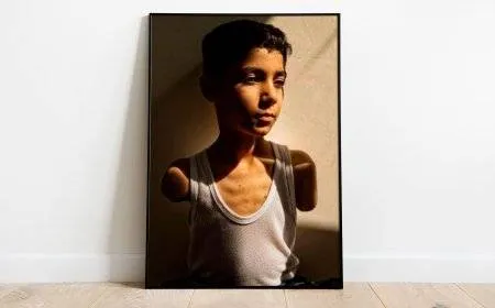 صورة طفل فلسطيني بترت ذراعاه تفوز بجائزة وورلد برس فوتو