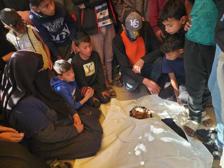 57 شهيدًا و137 إصابة وصلوا مستشفيات غزة خلال 24 ساعة الماضية