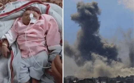 آثار العدوان على غزة .. ولادة طفلة بلا دماغ وتزايد ظاهرة تشوه الأجنة