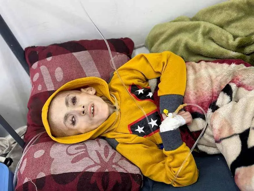 غزة : مجاعة تفتك بالأطفال وسط تصعيد عسكري وعجز دولي