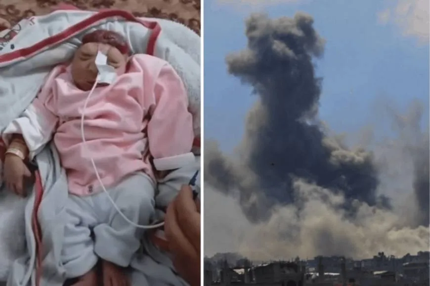 آثار العدوان على غزة .. ولادة طفلة بلا دماغ وتزايد ظاهرة تشوه الأجنة