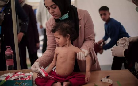 يونيسيف: ارتفاع عدد وفيات الأطفال في يوم ولادتهم والآلاف يعانون من سوء تغذية حاد بغزة