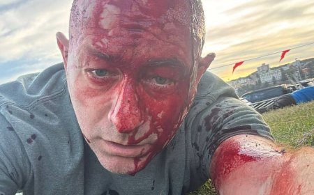 أستراليا تصنف هجوم بوندي على احتفال يهودي كعمل إرهابي