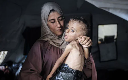 انعدام الأمن الغذائي 2026: غزة واليمن والسودان في بؤرة الجوع